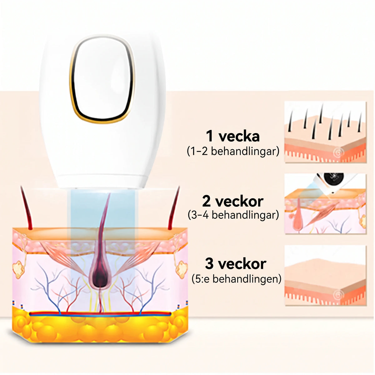 Scandiva IPL - Professionell hårborttagning hemifrån